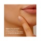 Isdin Acniben On the Spot Corretivo Facial Espinhas, 15 ml